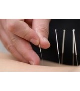 Acupuncture Needle